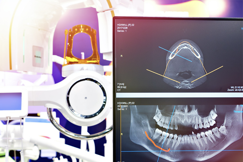 digital xrays